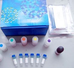人免疫球蛋白輕鏈lambda（λ-IgLC）ELISA Kit 產(chǎn)品說明與價(jià)格解析